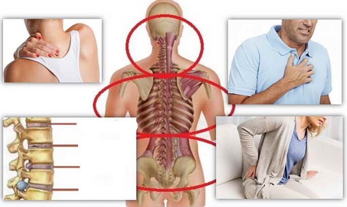 أماكن المرض لعظم العظم